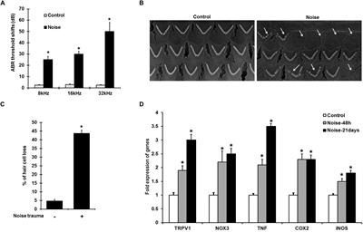 Targeting Inflammatory Processes Mediated by TRPVI and TNF-α for Treating Noise-Induced Hearing Loss